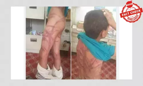 ইমেয়েনের শিশুর ছবি বাংলাদেশে স্কুলে নির্যাতনের বলে প্রচার ইমেয়েনের শিশুর ছবি বাংলাদেশে স্কুলে নির্যাতনের বলে প্রচার