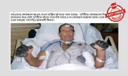 ভিন্ন ঘটনার দুটি ছবি যুক্ত করে কোরআন অবমাননাকারীর হাতে পঁচন ধরার দাবি ভিন্ন ঘটনার দুটি ছবি যুক্ত করে কোরআন অবমাননাকারীর হাতে পঁচন ধরার দাবি