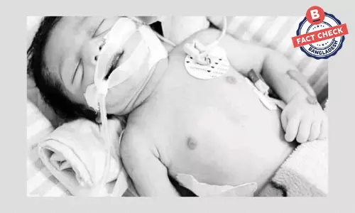 ছবির শিশুটি বাংলাদেশি নয়, সাহায্যের আবেদনটি ভুয়া