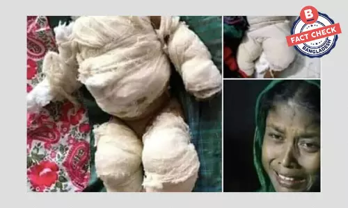 পৃথক ঘটনার একাধিক ছবি জুড়ে দিয়ে ফেসবুকে সাহায্যের ভুয়া আবেদন পৃথক ঘটনার একাধিক ছবি জুড়ে দিয়ে ফেসবুকে সাহায্যের ভুয়া আবেদন