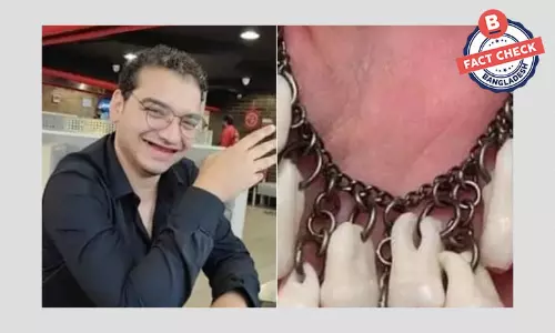 নিজের দাঁত তুলে গার্লফ্রেন্ডকে নেকলেস বানিয়ে দেয়ার ঘটনাটি সত্য নয় নিজের দাঁত তুলে গার্লফ্রেন্ডকে নেকলেস বানিয়ে দেয়ার ঘটনাটি সত্য নয়