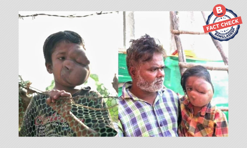 অসুস্থ শিশুটি বাংলাদেশি নয়, সাহায্যের আবেদন প্রতারণাপূর্ণ অসুস্থ শিশুটি বাংলাদেশি নয়, সাহায্যের আবেদন প্রতারণাপূর্ণ