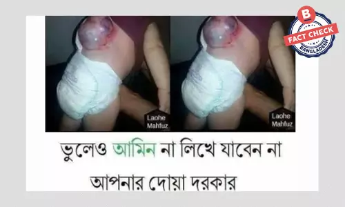 টিউমার আক্রান্ত শিশুর ছবিটি পুরোনো, সাহায্যের আবেদন প্রতারণাপূর্ণ টিউমার আক্রান্ত শিশুর ছবিটি পুরোনো, সাহায্যের আবেদন প্রতারণাপূর্ণ