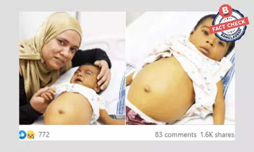 ছবিগুলো ভারতের অসুস্থ শিশু জোহান এর