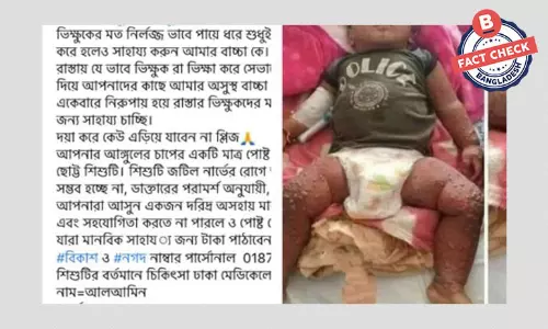 অজ্ঞাত শিশুর পুরোনো ছবিকে বাংলাদেশি শিশুর দাবি করে প্রতারণাপূর্ন সাহায্যে আবেদন অজ্ঞাত শিশুর পুরোনো ছবিকে বাংলাদেশি শিশুর দাবি করে প্রতারণাপূর্ন সাহায্যে আবেদন