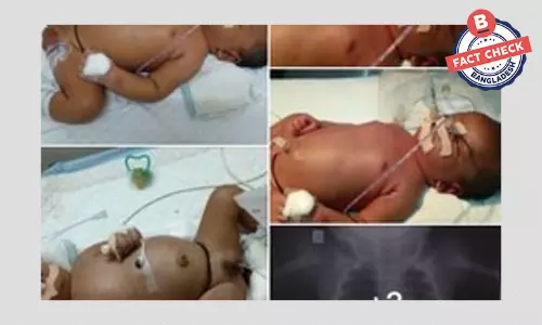 ছবির শিশুটি বাংলাদেশি নয় ছবির শিশুটি বাংলাদেশি নয়