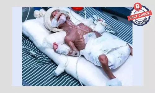 ছবির শিশুটি বাংলাদেশি নয়