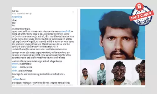 ছবিটি ভারতীয় এক ব্যক্তির, সাহায্য আবেদনটি ভুয়া ছবিটি ভারতীয় এক ব্যক্তির, সাহায্য আবেদনটি ভুয়া