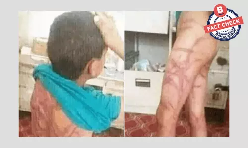 ছবিতে দৃশ্যমান আহত কিশোর ইয়েমেনের, ঘটনাটি ২০১৯ সালের ছবিতে দৃশ্যমান আহত কিশোর ইয়েমেনের, ঘটনাটি ২০১৯ সালের