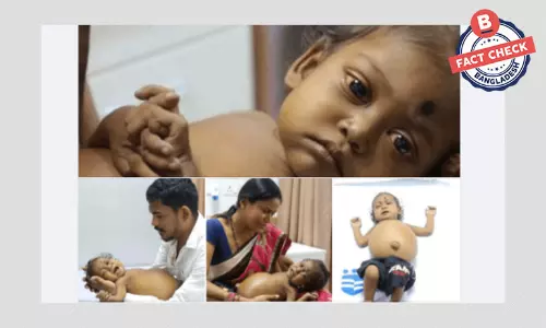 ছবিগুলো বাংলাদেশের কোনো অসুস্থ শিশুর নয় ছবিগুলো বাংলাদেশের কোনো অসুস্থ শিশুর নয়