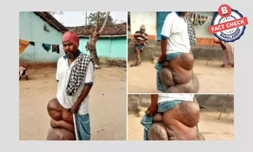 ছবিগুলো বাংলাদেশের কোনো ব্যক্তির নয় ছবিগুলো বাংলাদেশের কোনো ব্যক্তির নয়