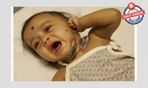 ছবিগুলো চারন্য নামের এক ভারতীয় শিশুর, বাংলাদেশি দাবি করা বিভ্রান্তিকর ছবিগুলো চারন্য নামের এক ভারতীয় শিশুর, বাংলাদেশি দাবি করা বিভ্রান্তিকর