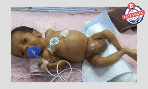 নেপালের শিশুকে বাংলাদেশি দাবি করে ভুয়া সাহায্যের আবেদন