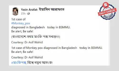 ডা. আসিফের নামে প্রচারিত বাংলাদেশে মাঙ্কিপক্স রোগী শনাক্তের খবরটি ভুয়া ডা. আসিফের নামে প্রচারিত বাংলাদেশে মাঙ্কিপক্স রোগী শনাক্তের খবরটি ভুয়া