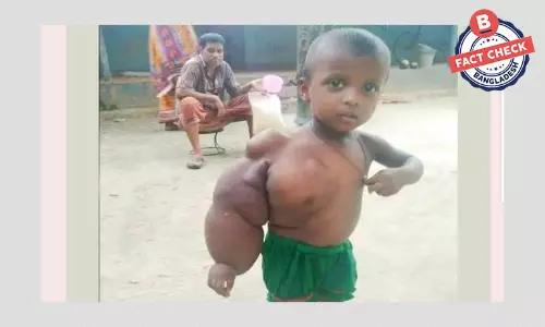 অসুস্থ শিশুর পাঁচ বছর পুরোনো ছবি দিয়ে সাহায্যের আবেদন অসুস্থ শিশুর পাঁচ বছর পুরোনো ছবি দিয়ে সাহায্যের আবেদন