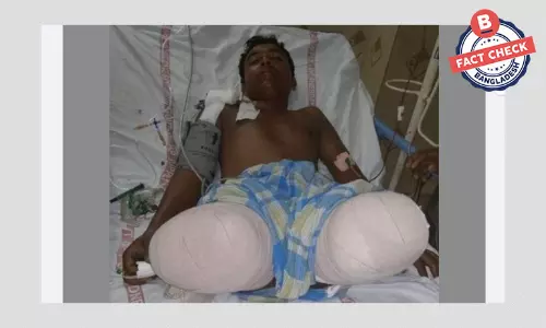 দুর্ঘটনায় আহত ভারতীয় ব্যক্তিকে বাংলাদেশি দাবি করে সাহায্যের আবেদন দুর্ঘটনায় আহত ভারতীয় ব্যক্তিকে বাংলাদেশি দাবি করে সাহায্যের আবেদন