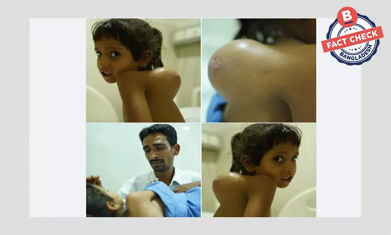 ভারতের অসুস্থ শিশু জয়ার ছবিকে বাংলাদেশের লিনা দাবি ভারতের অসুস্থ শিশু জয়ার ছবিকে বাংলাদেশের লিনা দাবি