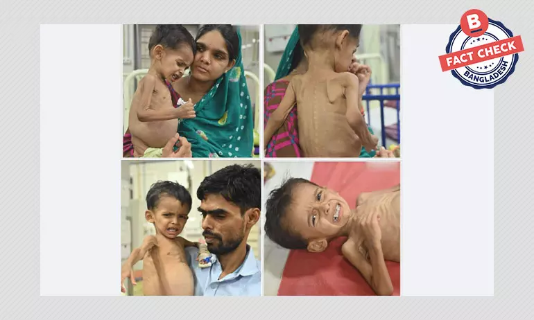 ভারতের অসুস্থ শিশু আরাসালানকে বাংলাদেশি দাবি করে সাহায্যের আবেদন ভারতের অসুস্থ শিশু আরাসালানকে বাংলাদেশি দাবি করে সাহায্যের আবেদন