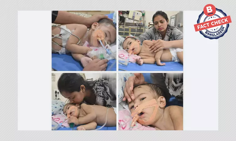 ভারতের অসুস্থ শিশু মানহাকে বাংলাদেশি দাবি করে সাহায্যের আবেদন ভারতের অসুস্থ শিশু মানহাকে বাংলাদেশি দাবি করে সাহায্যের আবেদন