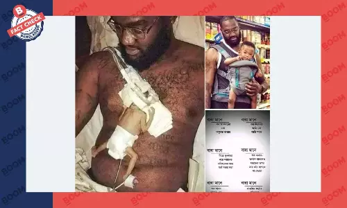 ছবিটি যুক্তরাষ্ট্রে প্রিম্যাচিউর বেবিকে পিতার দেয়া স্কিন থেরাপির