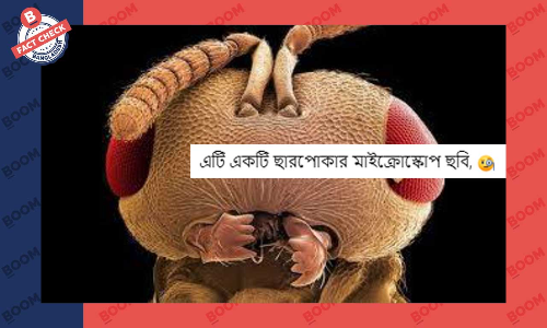 ভাইরাল হওয়া ছবিটি ছারপোকার মাইক্রোস্কোপ ভিউ নয়