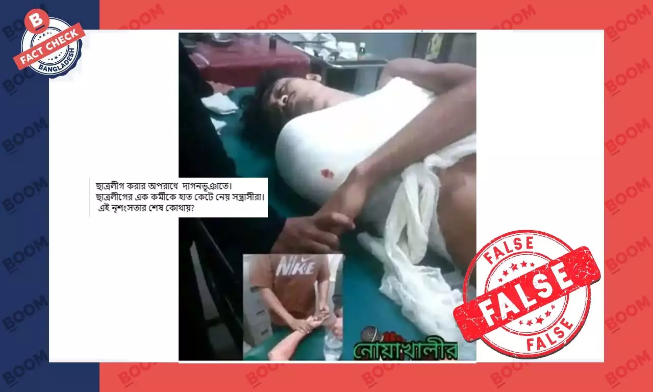 ট্রাকের ধাক্কায় তরুণের বিচ্ছিন্ন হাতের ছবি বিভ্রান্তিকর দাবিসহ প্রচার ট্রাকের ধাক্কায় তরুণের বিচ্ছিন্ন হাতের ছবি বিভ্রান্তিকর দাবিসহ প্রচার