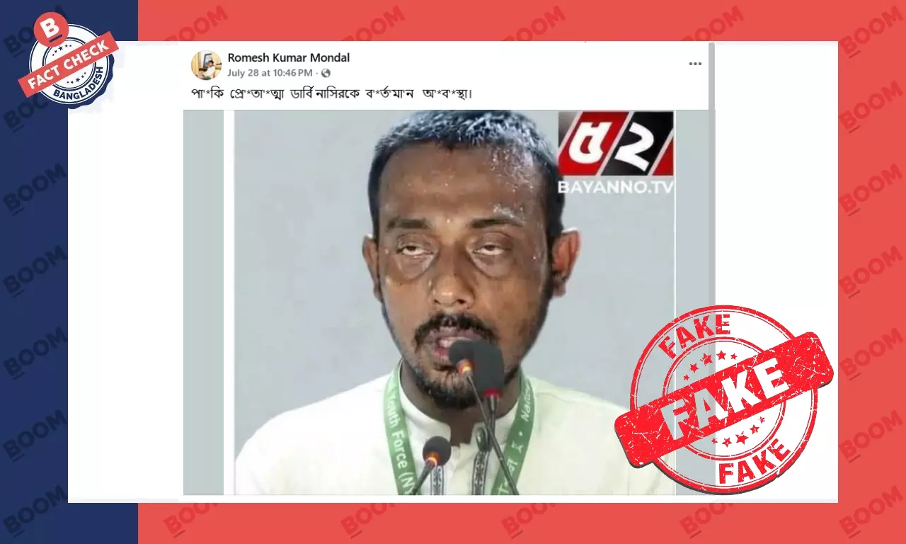 নাসীরুদ্দীন পাটোয়ারী আহত অবস্থার ছবি দাবিতে এআই জেনারেটেড ছবি প্রচার নাসীরুদ্দীন পাটোয়ারী আহত অবস্থার ছবি দাবিতে এআই জেনারেটেড ছবি প্রচার